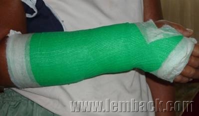 Sprained wrist?
